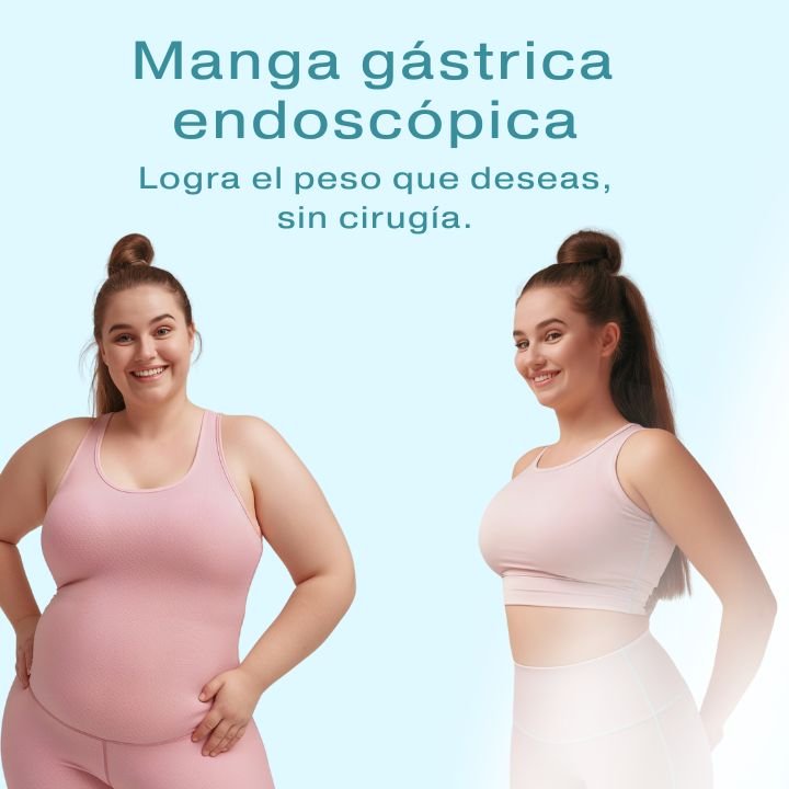 Especialista en Endoscopia bariatrica Queretaro